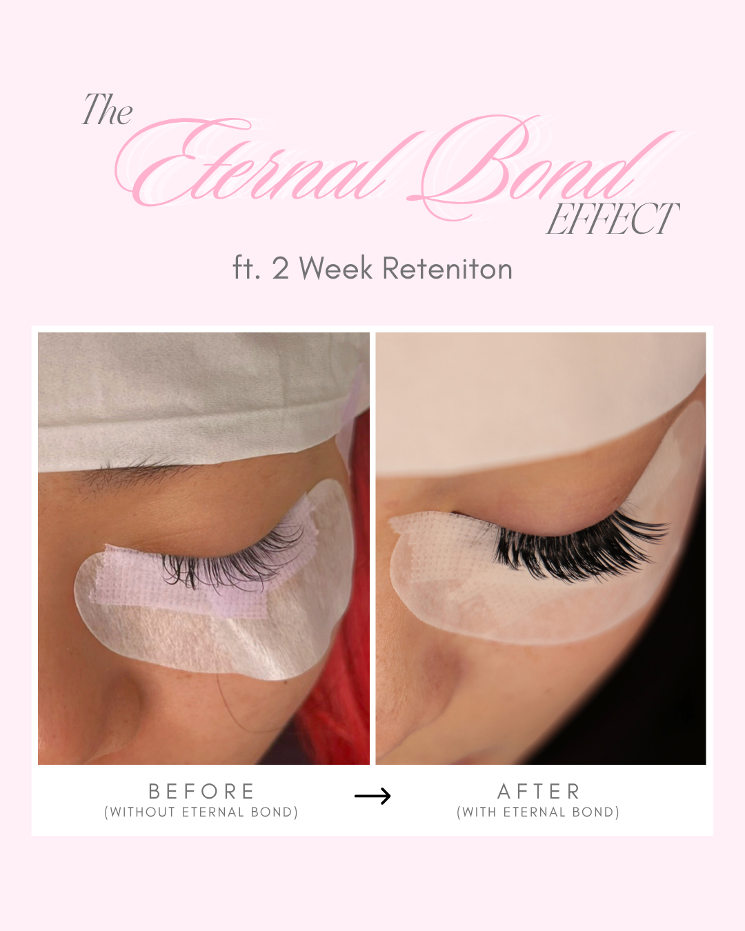 Eternal Bond Adhesive